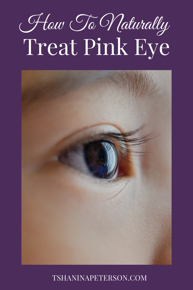 Do you want to learn how to naturally treat pink eye? I'm sharing the essential oil home remedy I used to treat this contagious virus. You'll be amazed at how quickly it will clear up your kid's eyes (or even your own)!